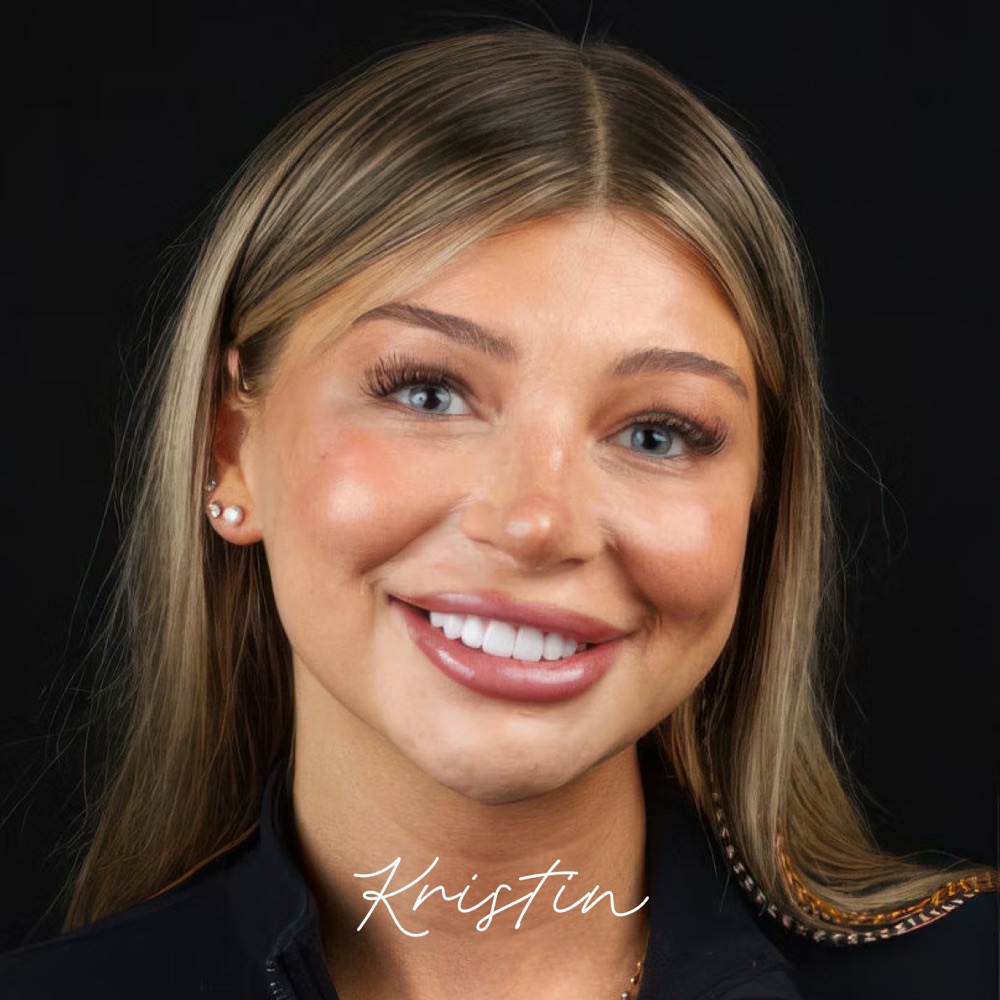 Kristin after no-prep veneers
