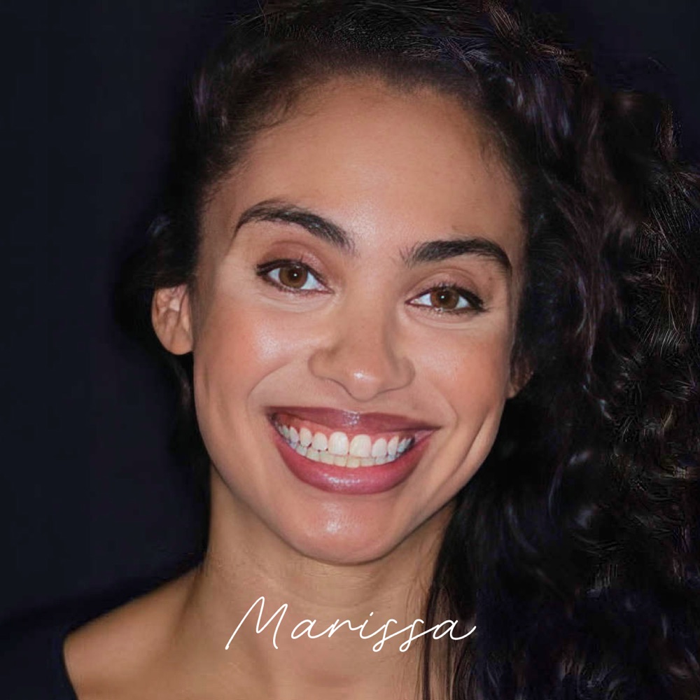 Marissa after Invisalign
