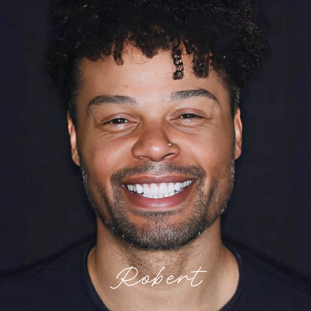 Robert after veneers and gum lifting