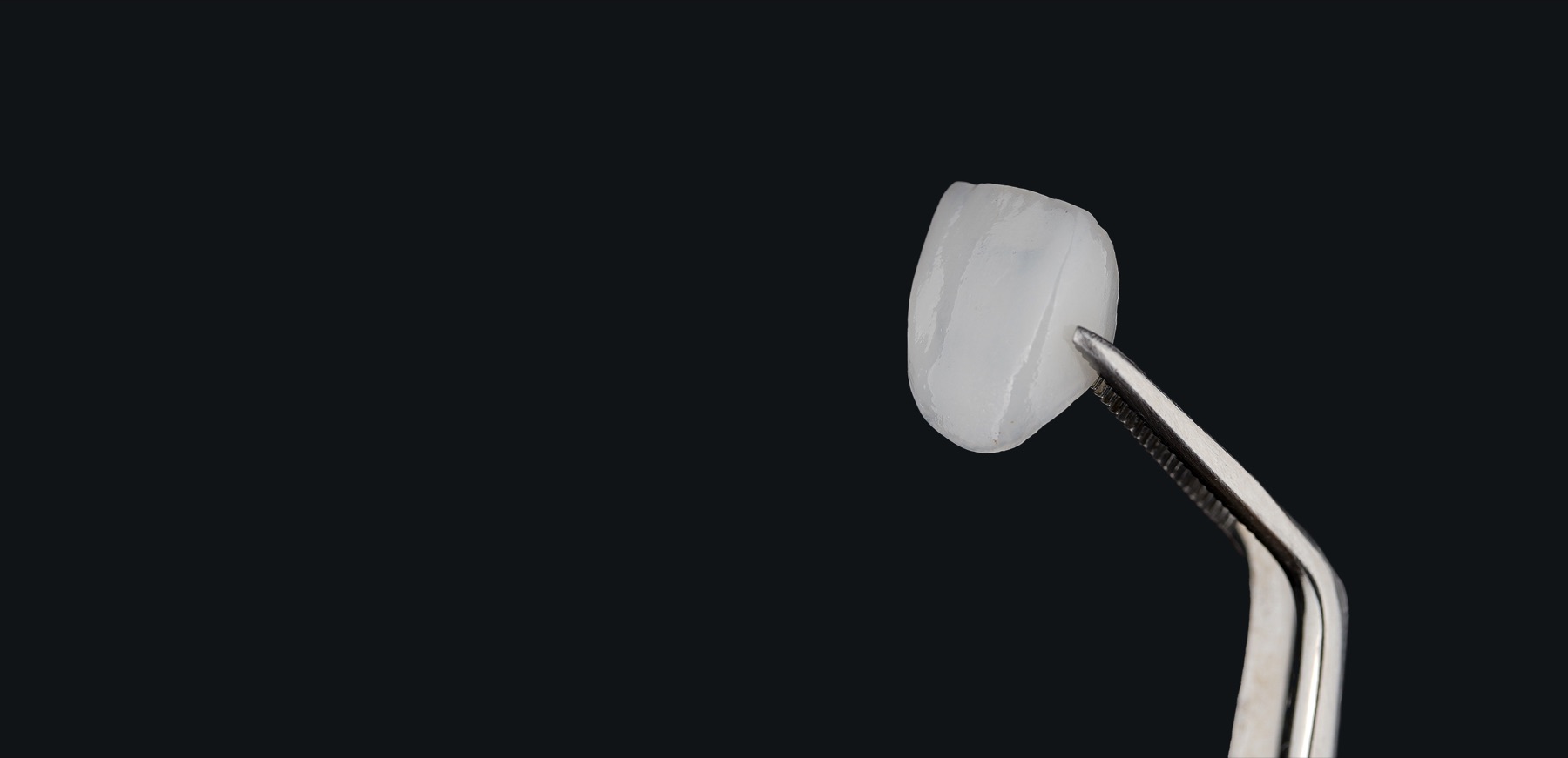 A single porcelain veneer held in tweezers